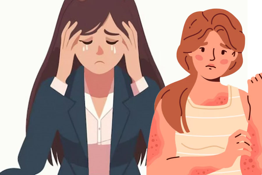 Prolonged stress can worsen eczema and psoriasis. Graphics: Thien Nhan