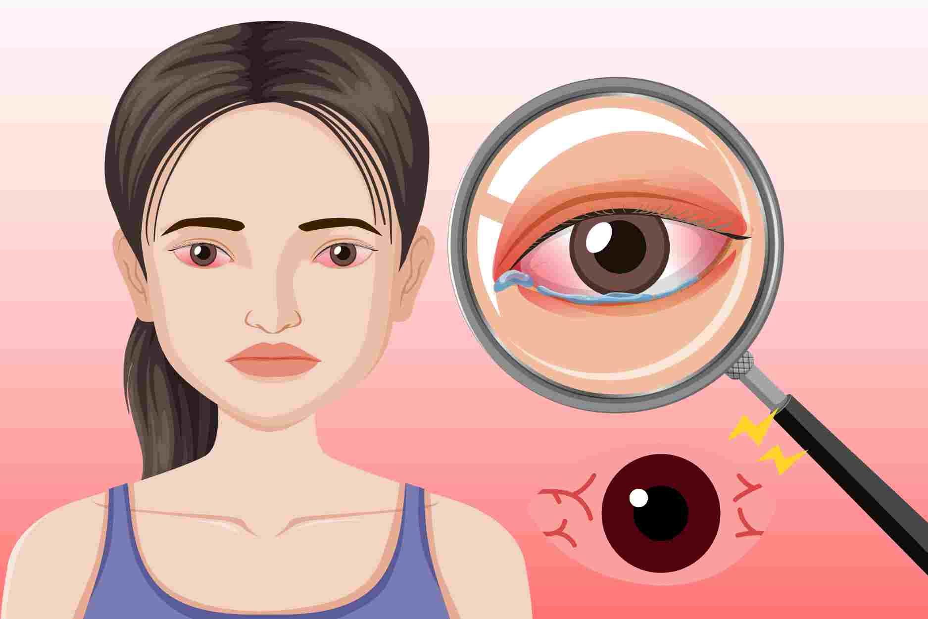 Causes of cataracts