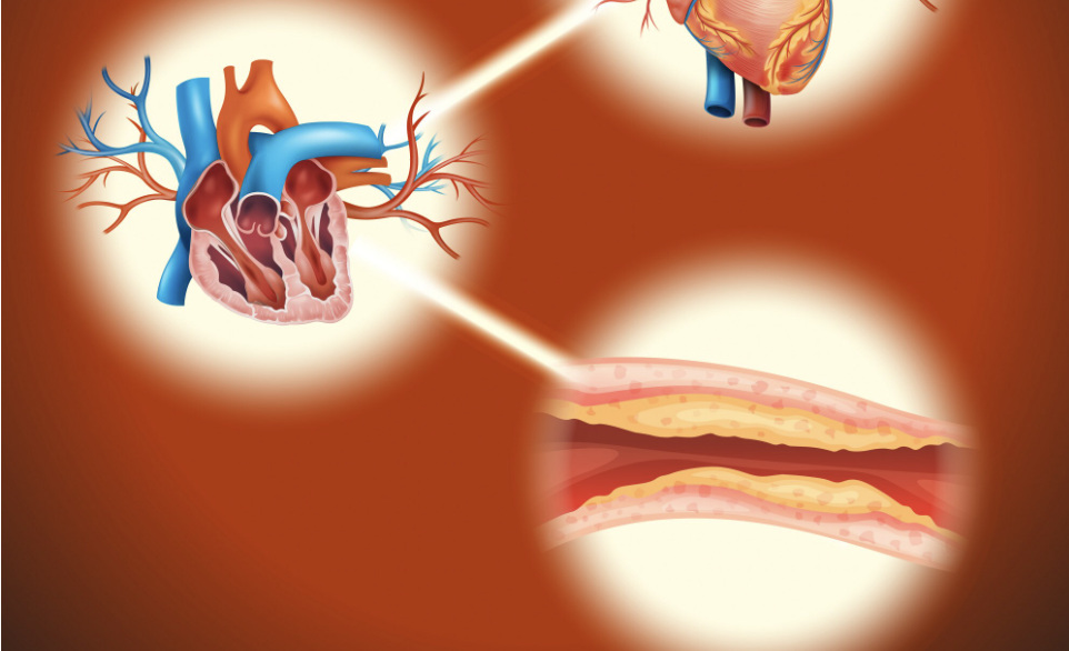 Left arm pain makes many people afraid of myocardial infarction. Photo: Thuy Duong