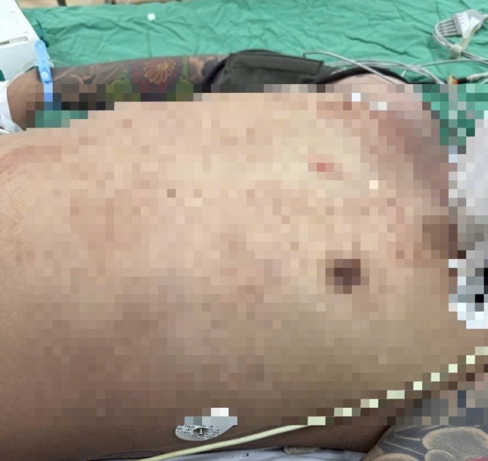 Bệnh nhân khi được cấp cứu tại bệnh viện. Ảnh: Phạm Duy 