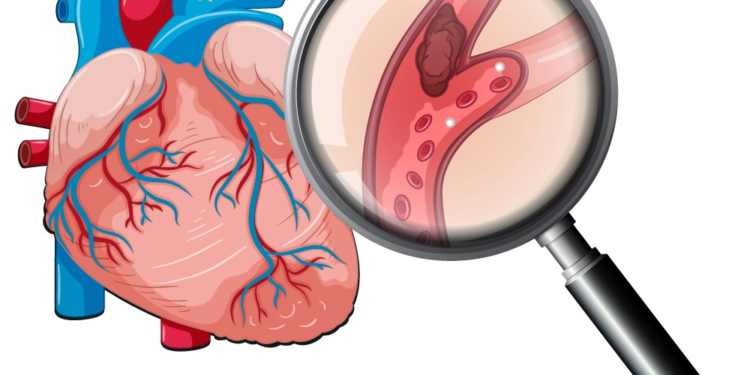 Doctors warn about the increasingly younger cardiovascular disease. Photo: Khanh Hoa Provincial General Hospital