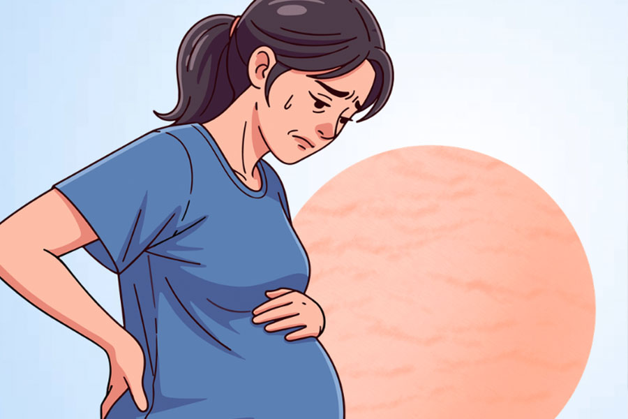 Stretch marks during pregnancy and effective preventive measures. Graphics: Thien Nhan