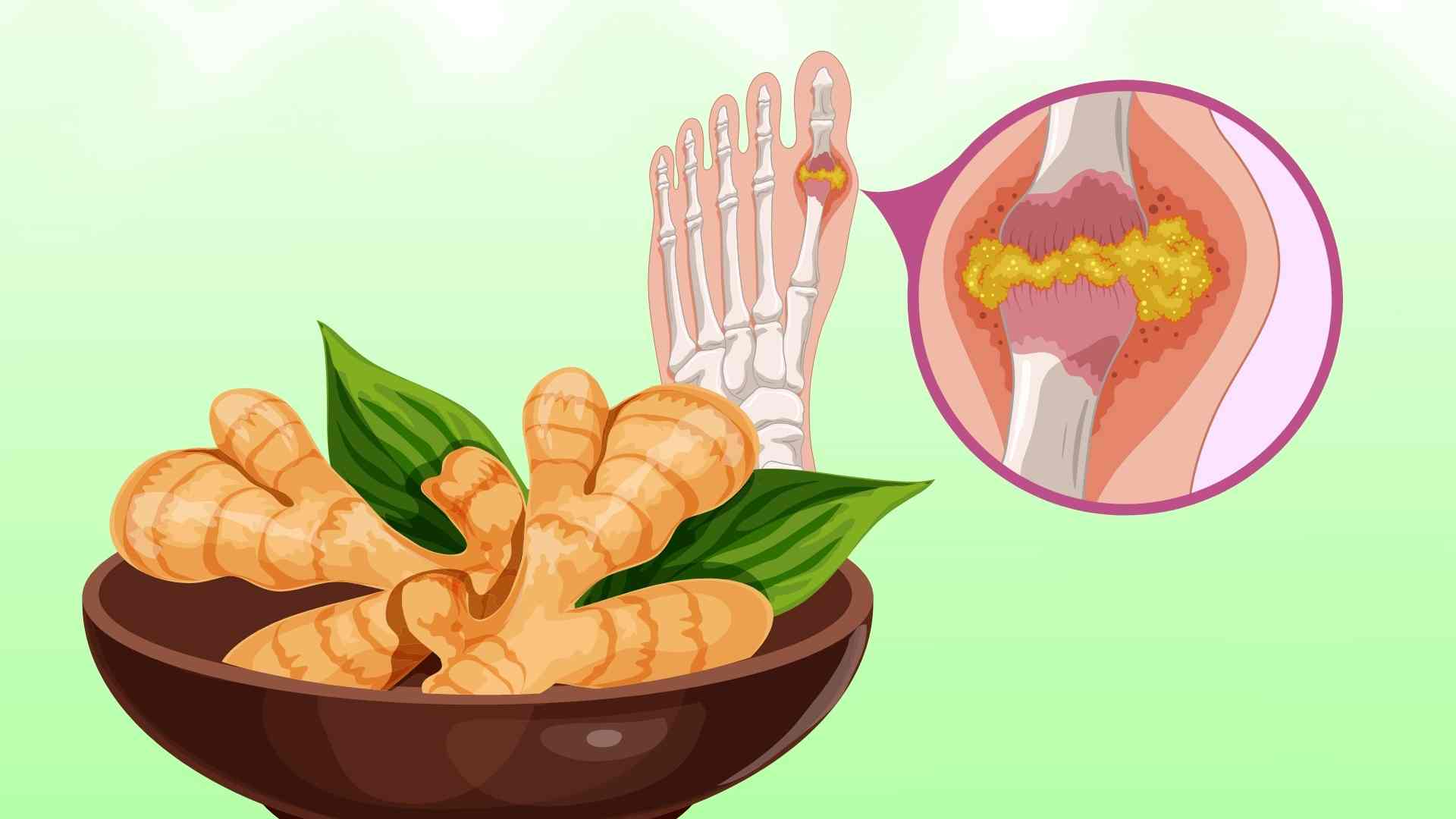 Tips for using ginger to help reduce joint pain and improve high uric acid levels