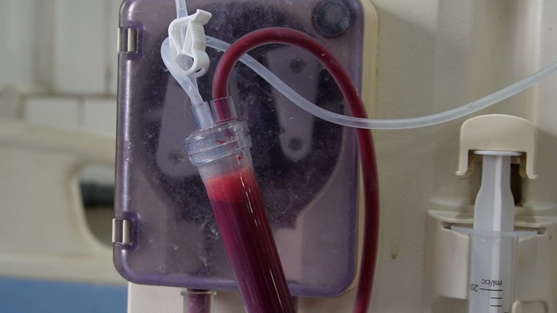 Bác sĩ khuyến cáo bệnh nhân kiểm soát việc ăn uống ngày Tết, tránh ảnh hưởng đến sức khoẻ và quá trình điều trị, lọc máu. Ảnh: Hạnh Thơm