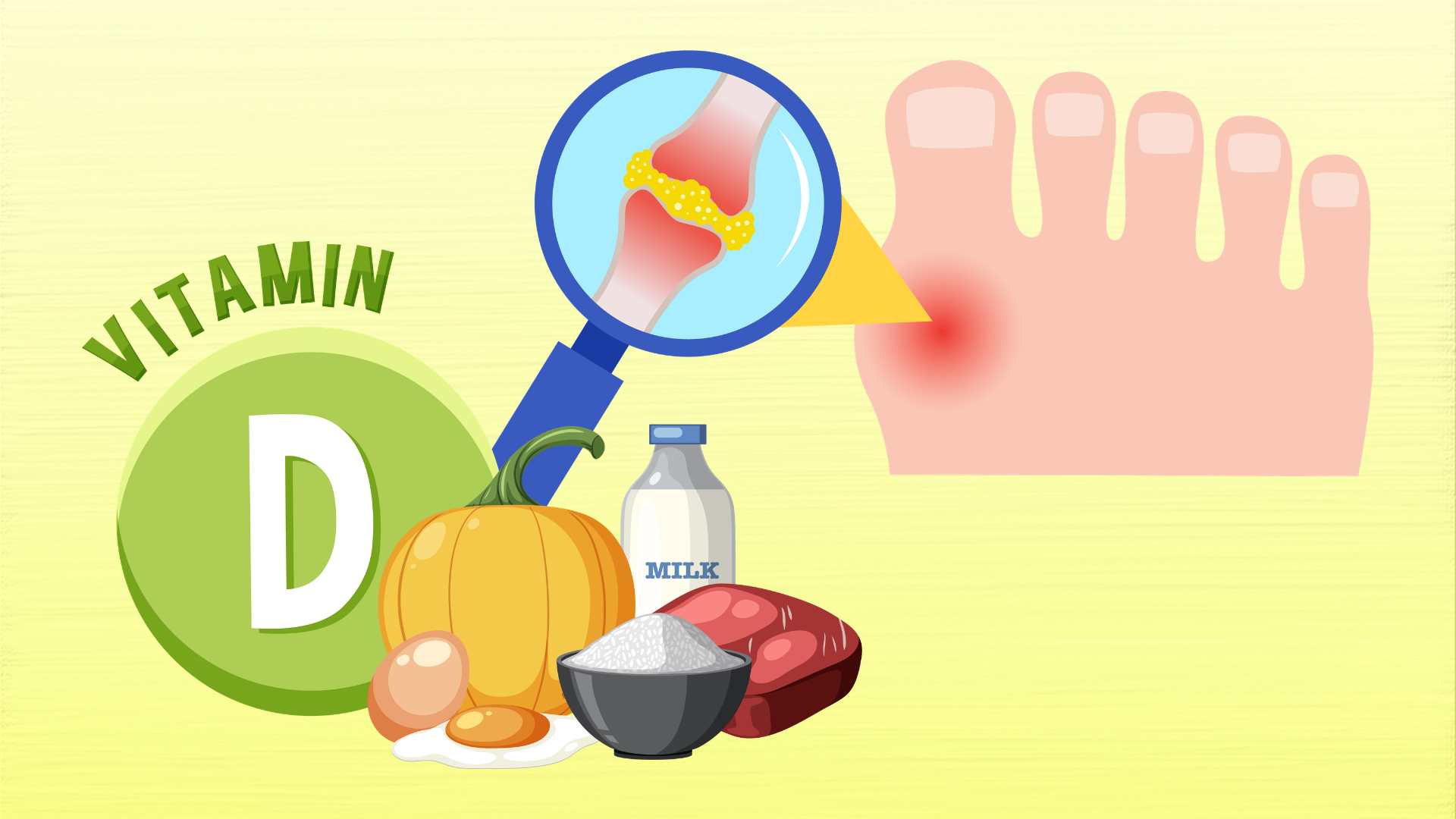 People with high uric acid need to supplement these nutrients during Tet