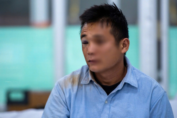 Dịp Tết, trong khi các bệnh lý nội khoa duy trì ở mức ổn định thì số lượng ca tai nạn và chấn thương lại tăng vọt, con số vượt trội hoàn toàn. Trên giường bệnh, anh T.L. (quê Lâm Đồng) bàng hoàng nhớ lại tai nạn giao thông sau chầu nhậu ngày xuân: “Lúc lên xe đi, em cứ nghĩ là mình vẫn đang rất tỉnh táo, chạy xe được và chắc là sẽ không sao đâu. Không ngờ lại xảy ra cơ sự này...”. Một sự ân hận muộn màng gác lại niềm vui năm mới.