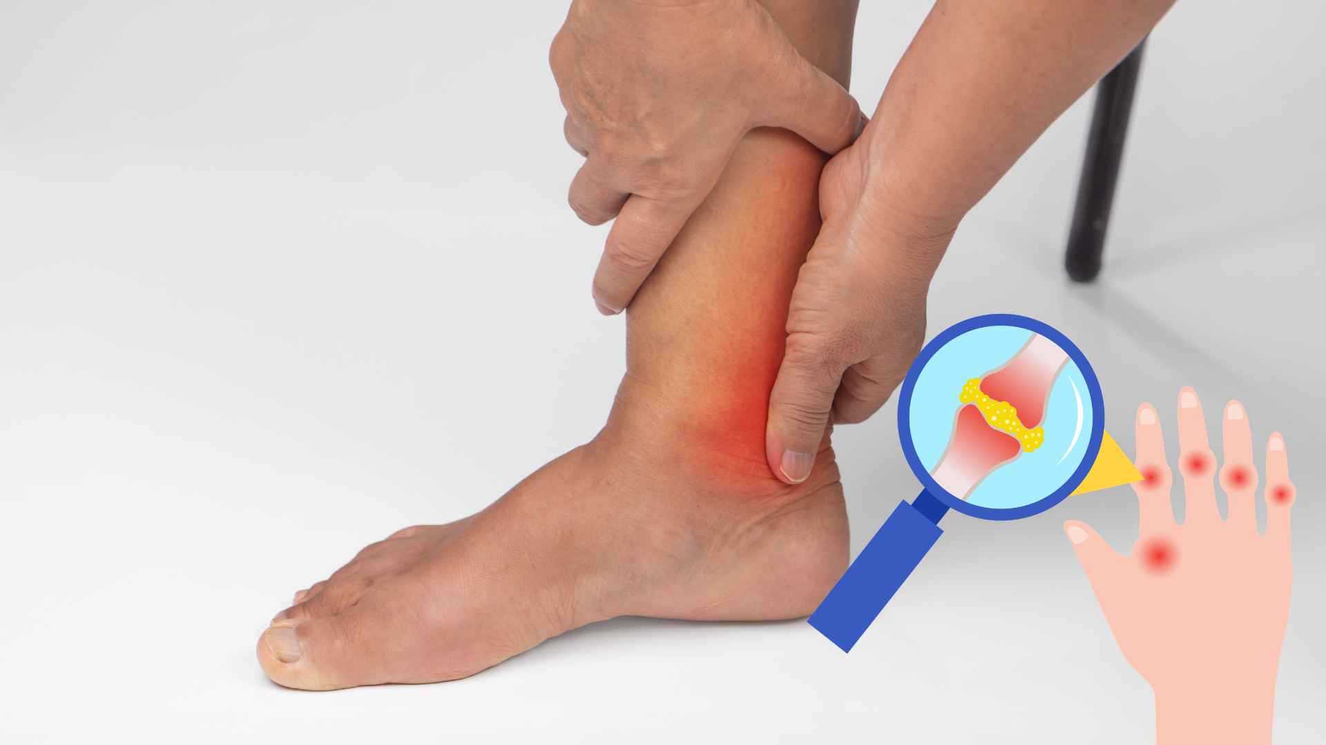 Relaxing walking for 15 minutes each night helps minimize uric acid buildup. Graphic photo: Huong Son