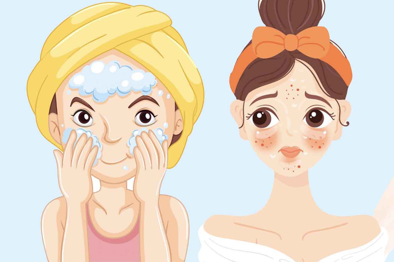 Excessive exfoliation can cause serious damage to the skin. Graphics: Thien Nhan