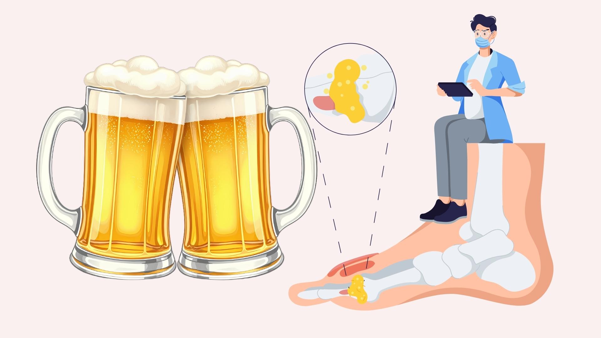 Lower uric acid after drinking a lot of alcohol and beer during Tet. Graphics: Linh Dan