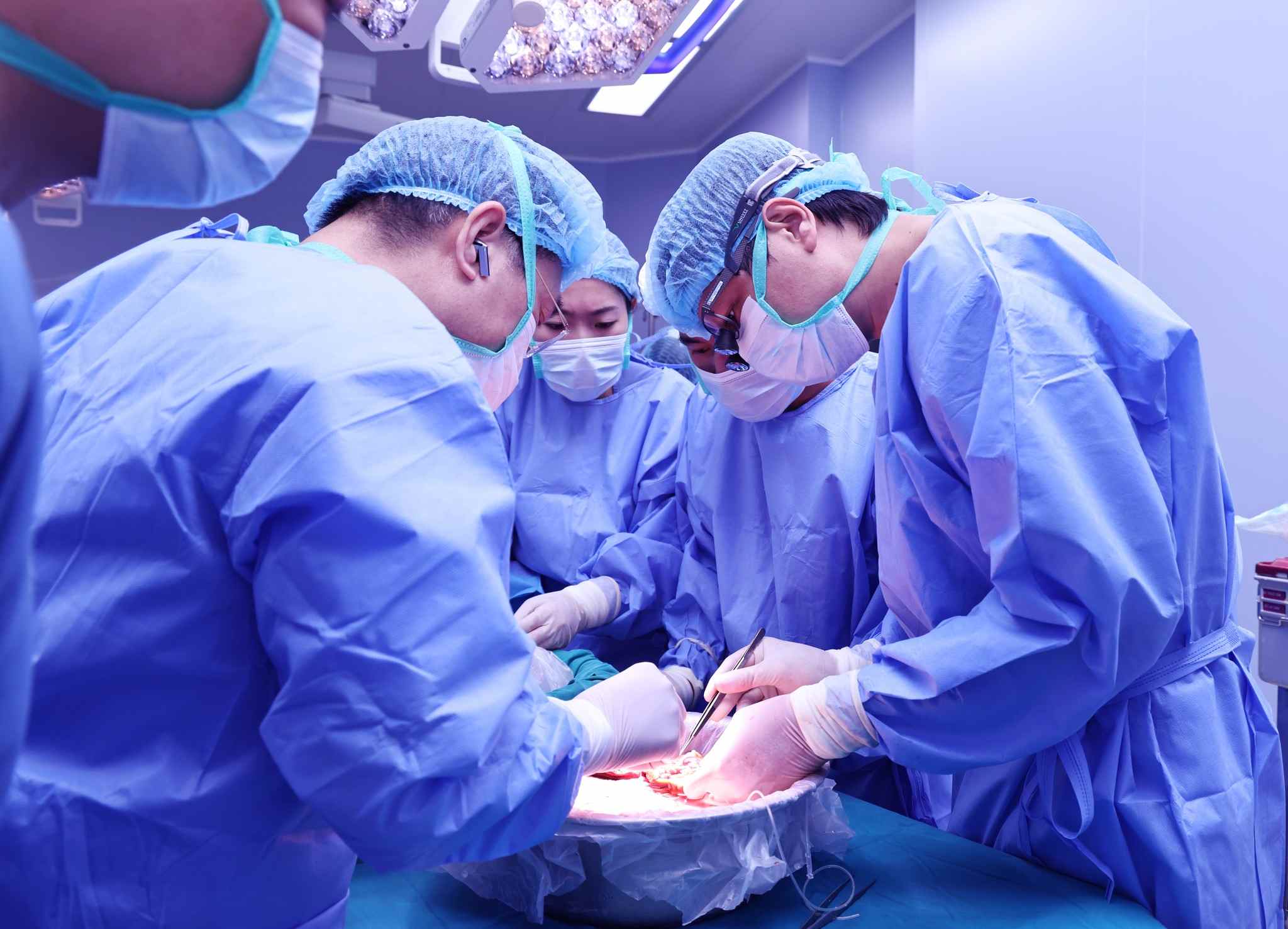 Ca chia gan tại Bệnh viện Trung ương Quân đội 108. Ảnh: BVCC