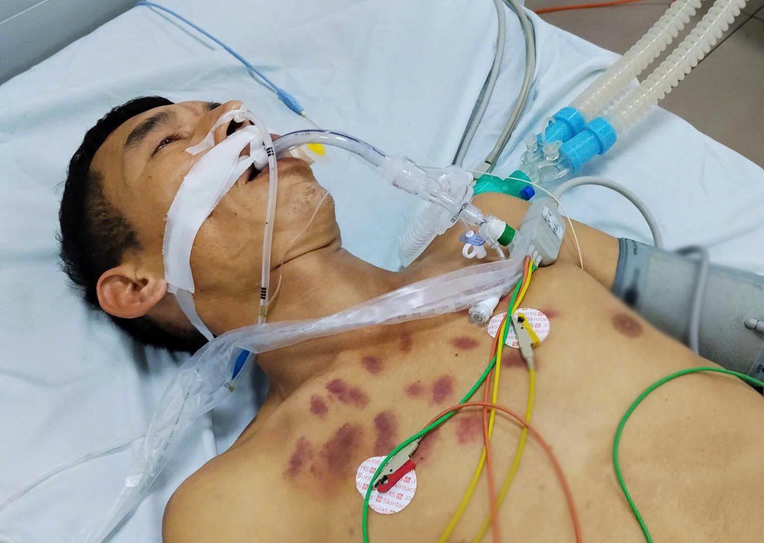 Anh Vàng Văn Tuấn cha nuôi của em Nghĩa bệnh năng, chi phí điều trị tốn kém khiến áp lực lên cuộc sống của cha con vốn đã khó khăn. Ảnh: PV.