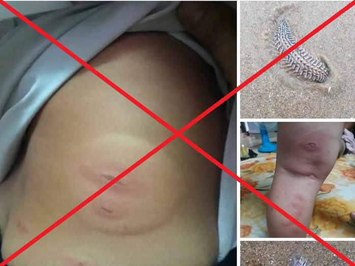 Vung Tau General Hospital warns that the content of needing rare blood for emergency care is fake information. Photo: BVCC