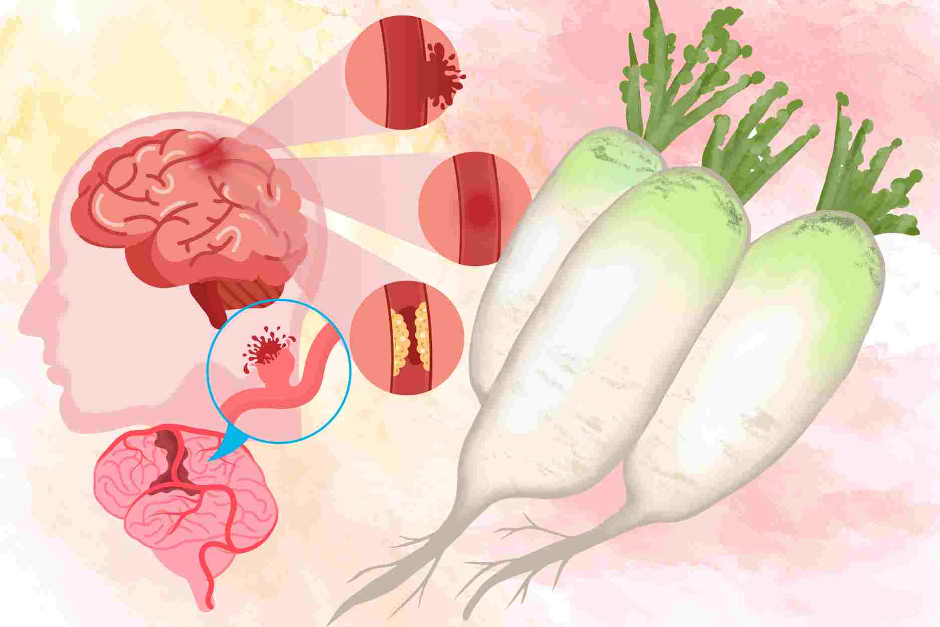 Why radish is good for cardiovascular health and stroke prevention