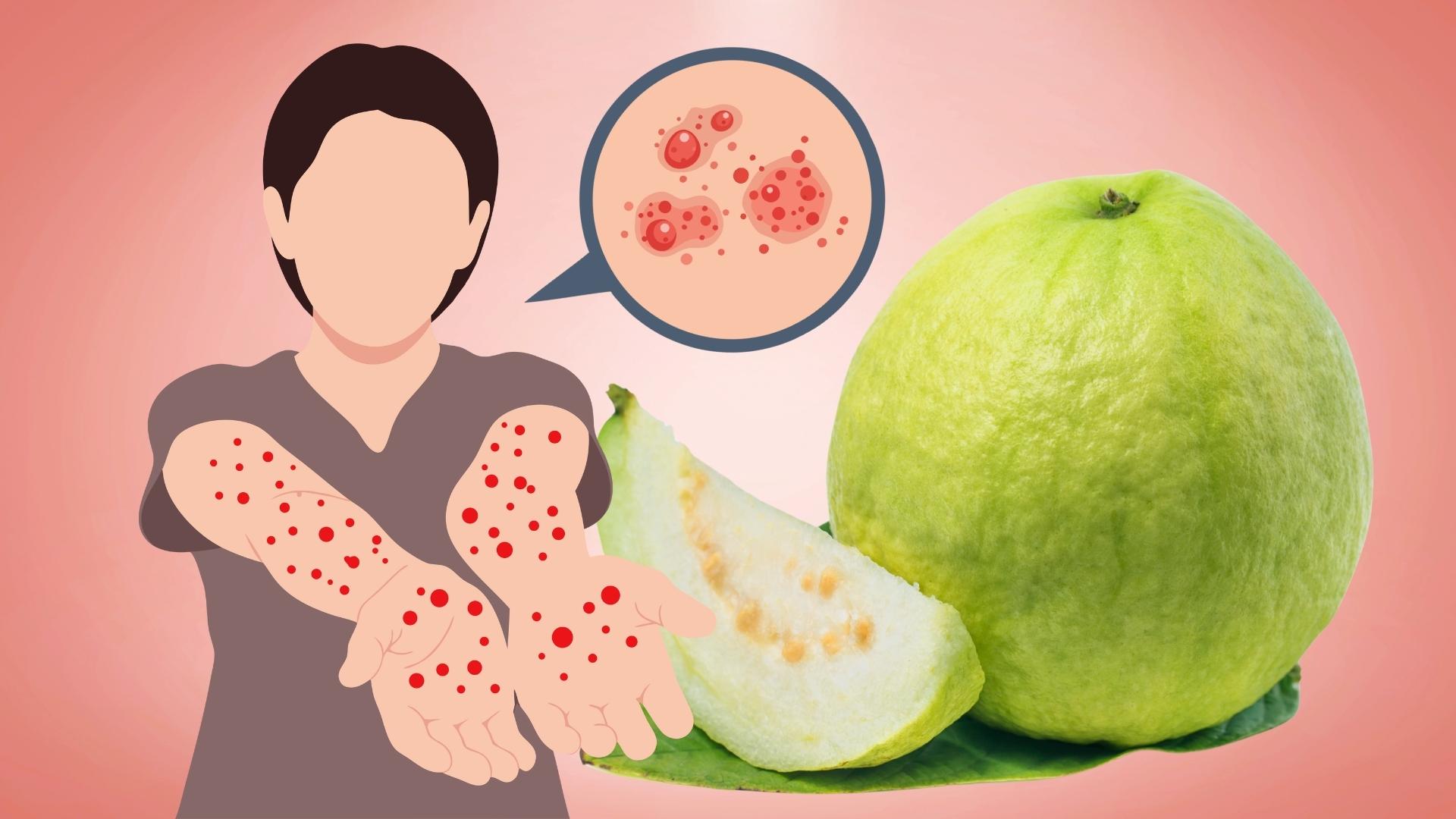 Who should limit eating guava to avoid affecting health