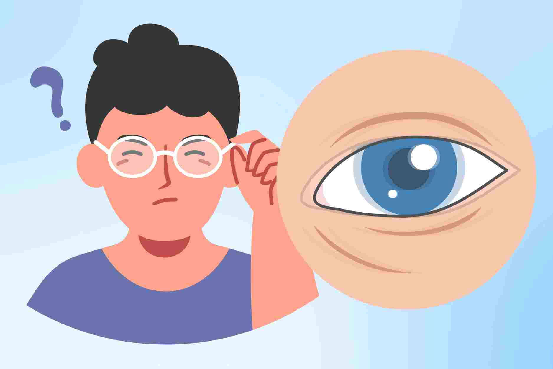 Why do eyes look blurry and dull