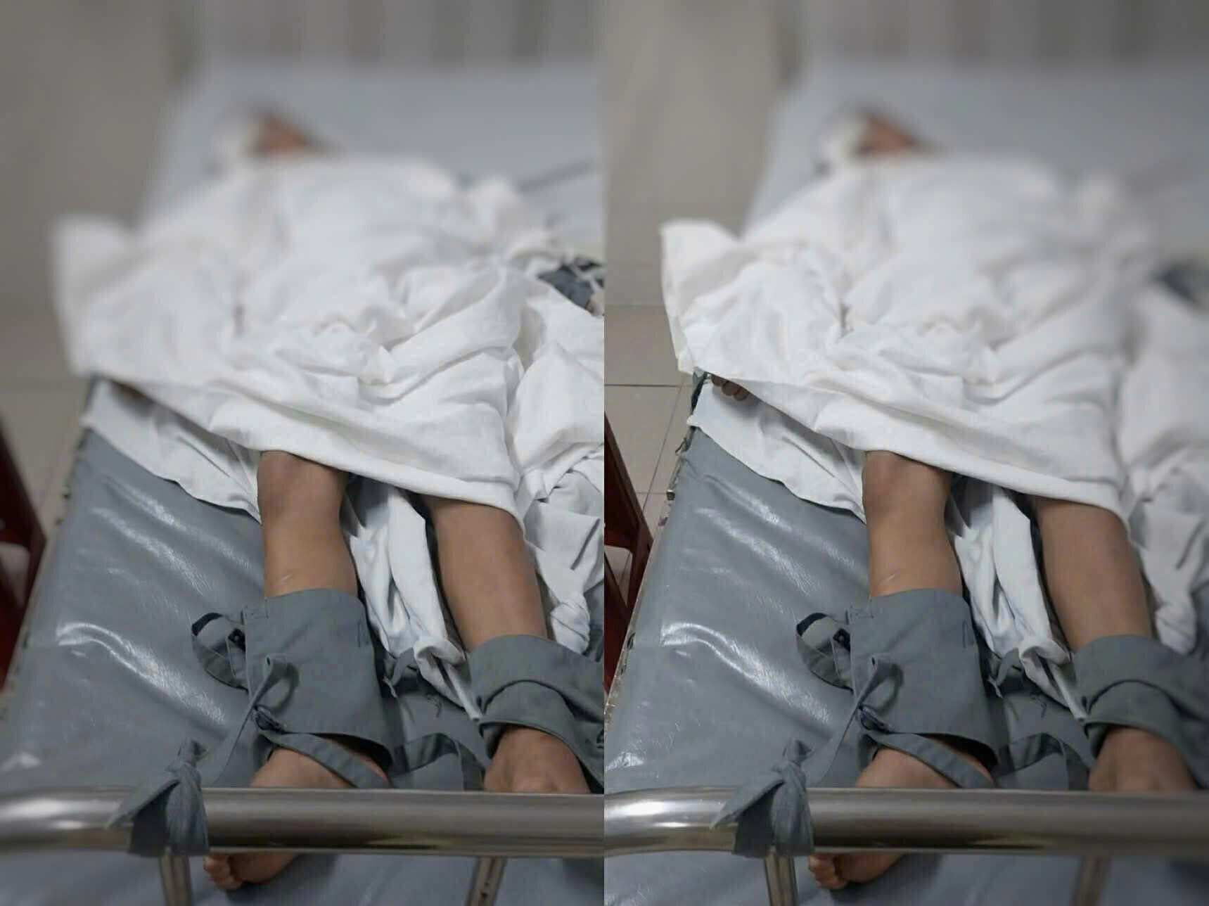 T.V. T (1st grade student) is being treated at the hospital due to an eye injury. Photo: Tung Linh