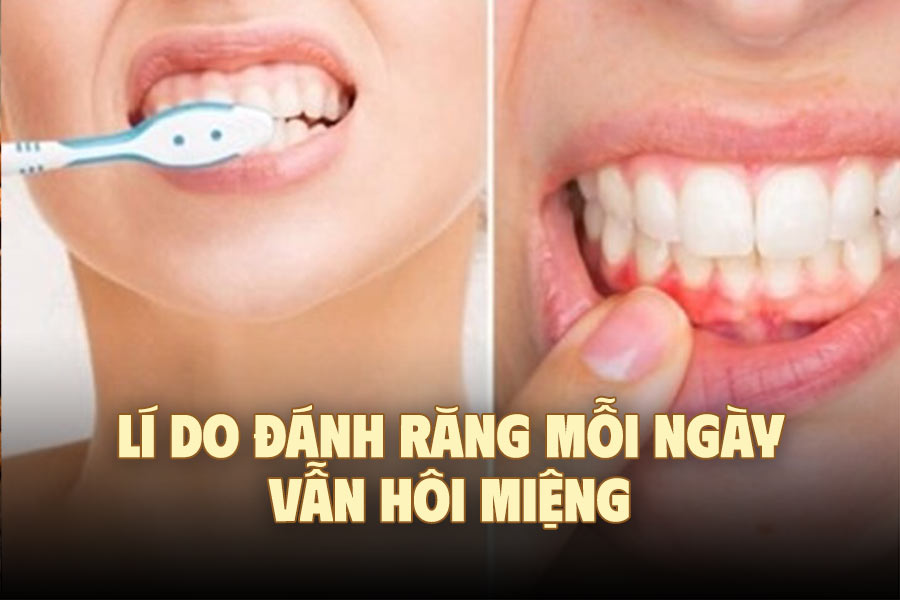 Reasons why brushing teeth every day still causes bad breath