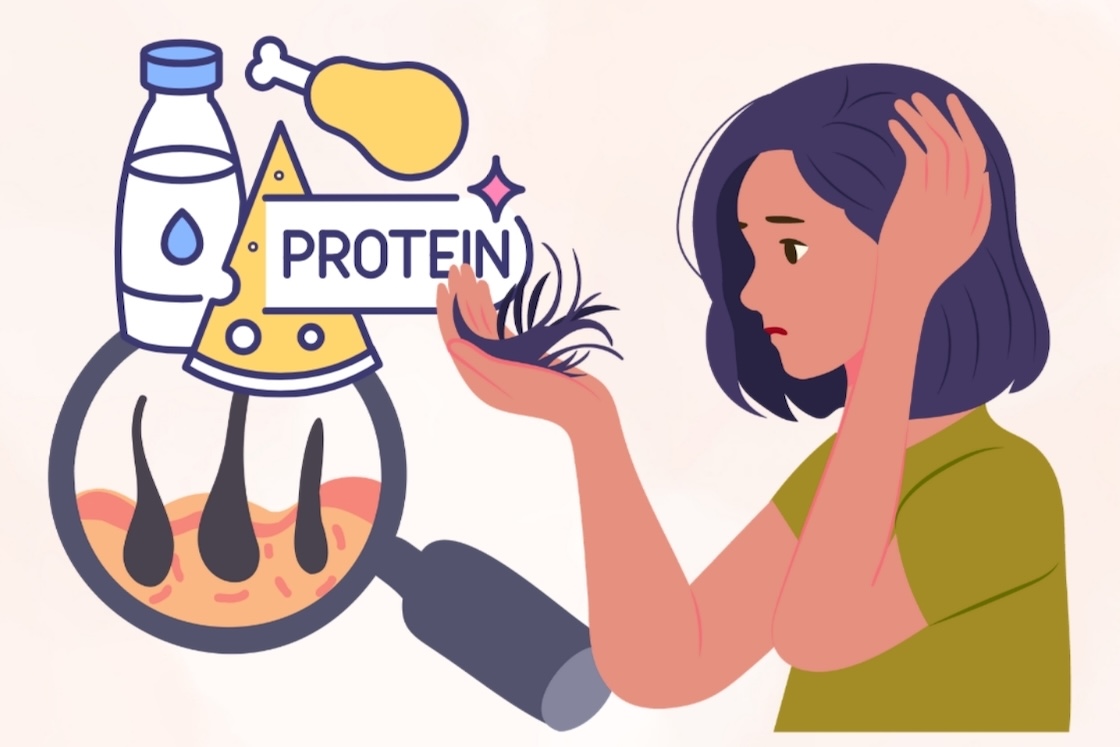 Signs of hair loss that may be related to protein deficiency