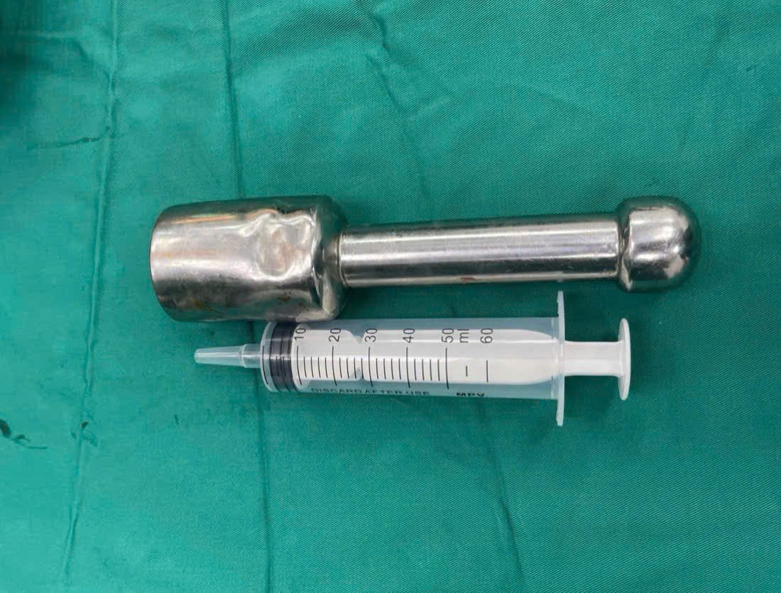 Image of the pestle removed from the patient's anus after emergency treatment. Photo: BVCC