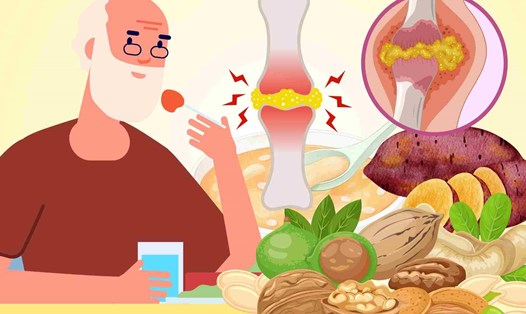 The uric acid index may increase due to many factors. Photo: Huyen Trang