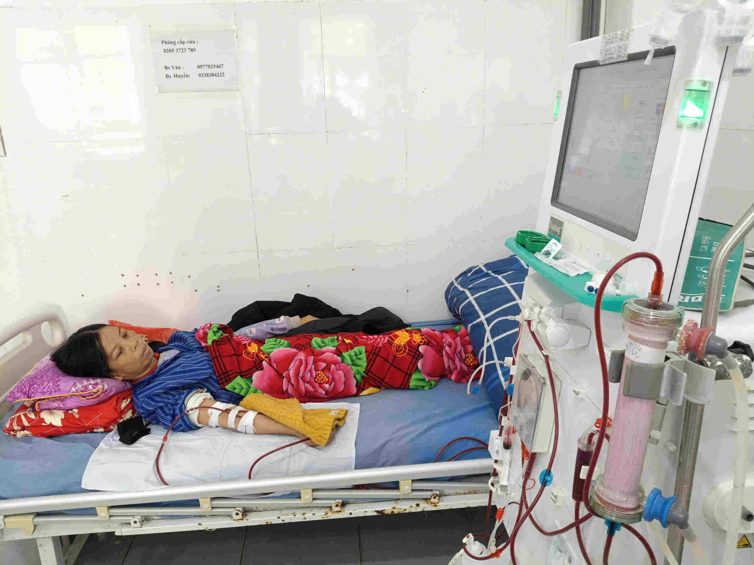 Ms. Hang is undergoing dialysis at the Emergency - Intensive Care and Poison Control Department, Chi Lang Regional Medical Center, Lang Son province. Photo: NVCC