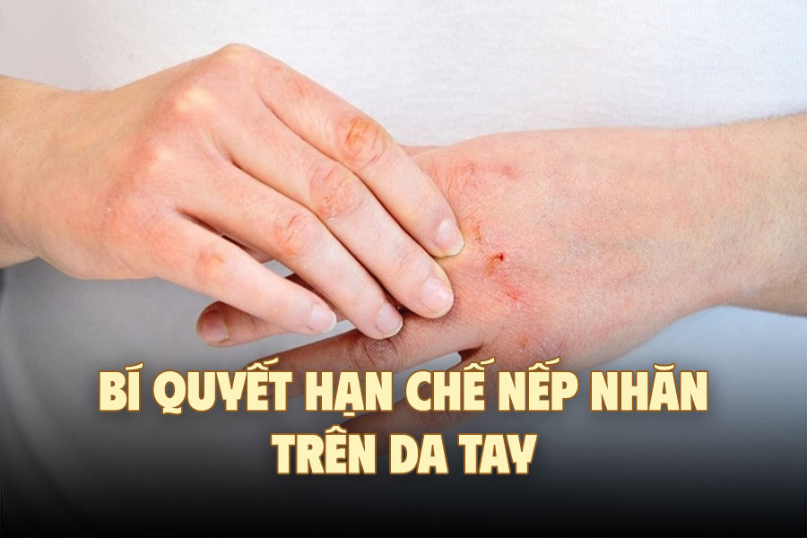 Secrets to limiting wrinkles on your hands