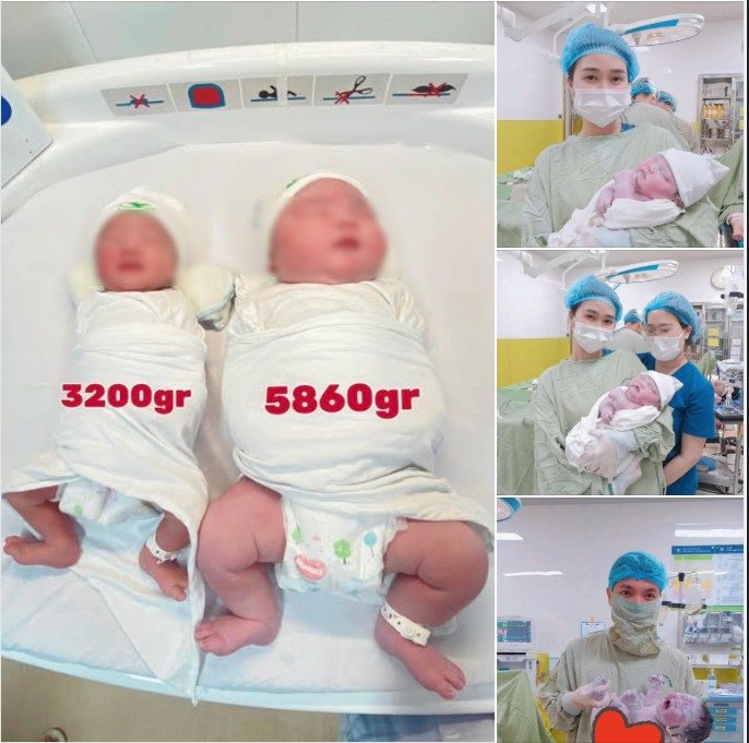 Baby boy weighing nearly 6kg born at Hanoi Obstetrics and Gynecology Hospital. Photo: BVCC