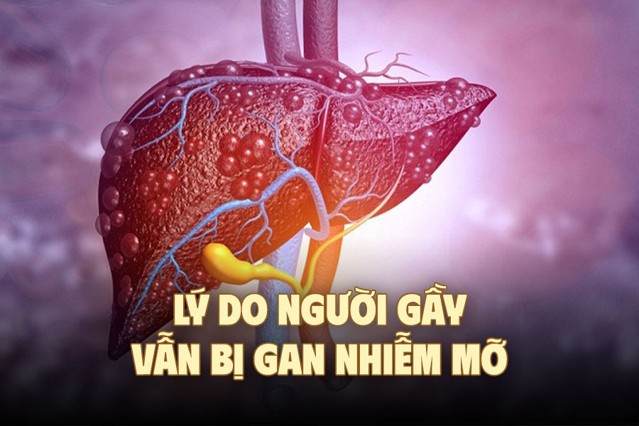 Reasons why skinny people still have fatty liver