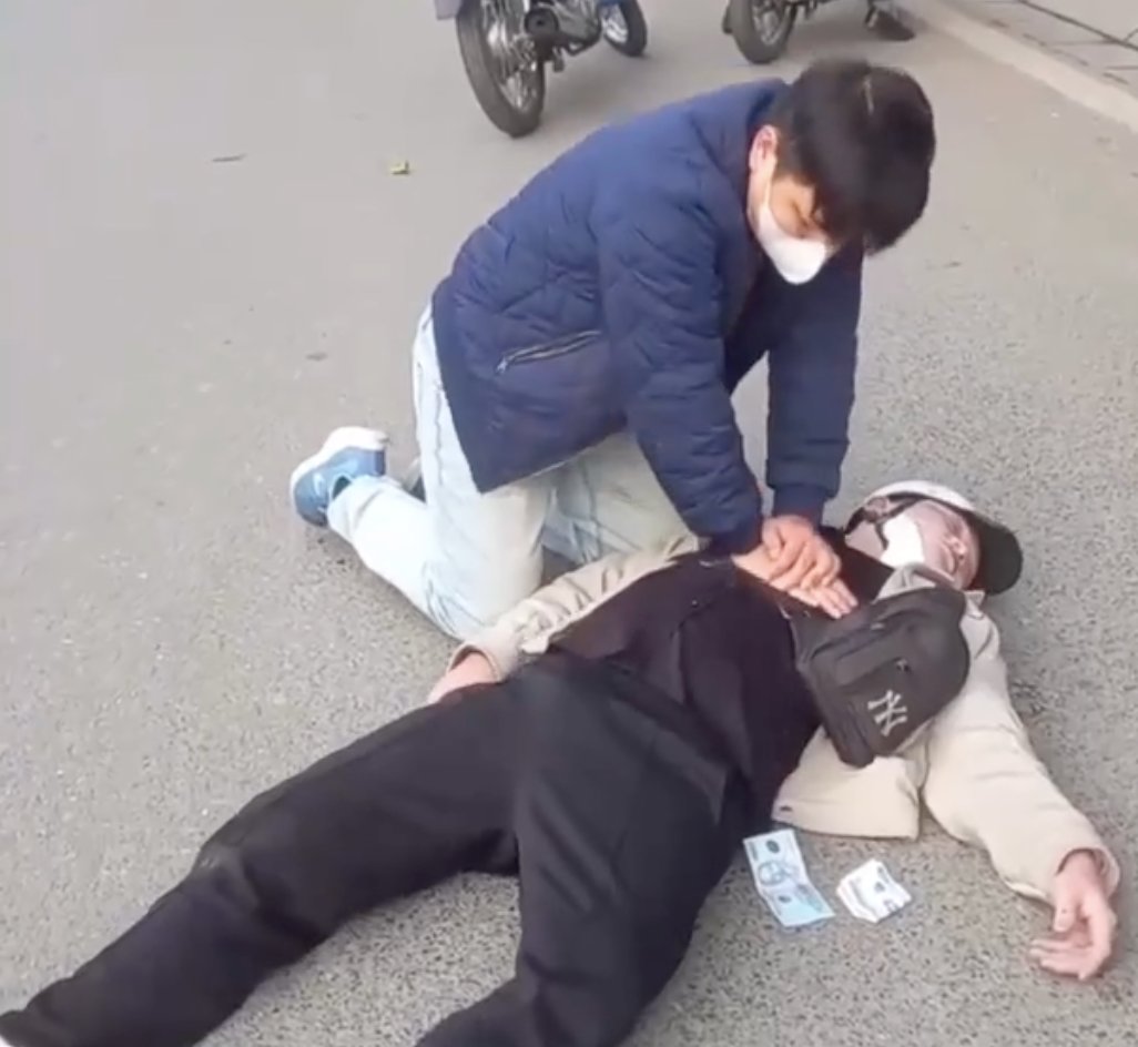 Timely cardiac tamponade, doctors save young man from circulatory arrest. Photo cut from clip