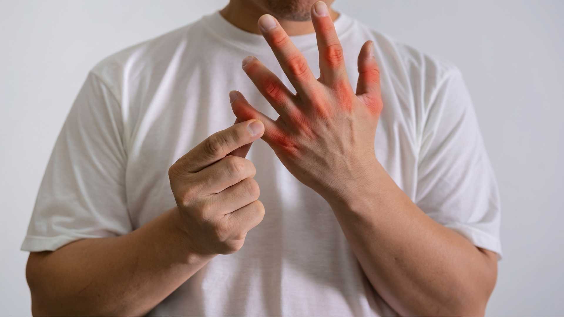 Factors that cause uric acid to spike in hot weather