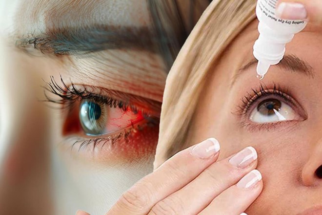 Chemical conjunctivitis: Symptoms and prevention. Graphics: Thien Nhan
