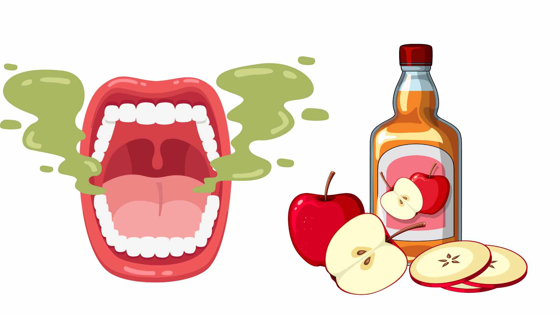 El vinagre de sidra de manzana contiene ácido acético, un compuesto que tiene propiedades antibacterianas leves, reduciendo eficazmente el mal aliento. Foto gráfica: Hương Sơn