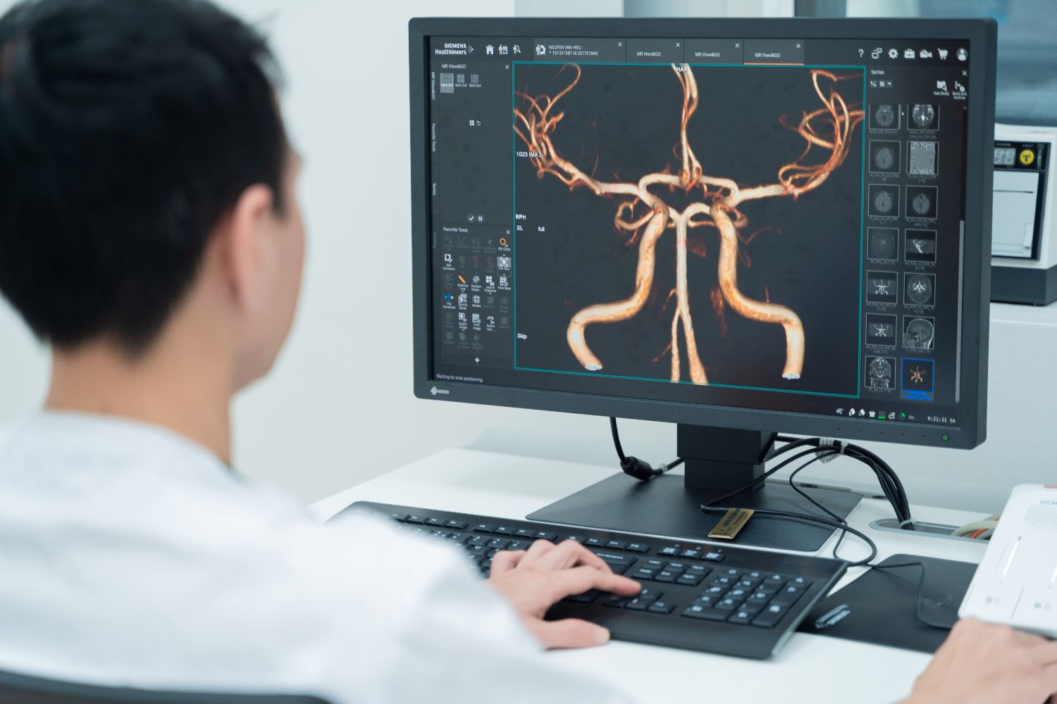 Với công nghệ tích hợp trí tuệ nhân tạo (AI), thiết bị cho phép tái tạo hình ảnh sắc nét đến từng milimet, giúp phát hiện sớm các tổn thương thần kinh, ung thư ngay từ giai đoạn đầu. Đồng thời, máy được cải tiến với thời gian chụp được rút ngắn, vận hành êm ái hơn, nâng cao trải nghiệm cho người bệnh.