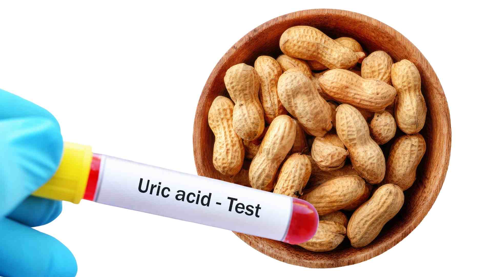 Eating a lot of roasted peanuts can affect uric acid. Graphics: Ha May