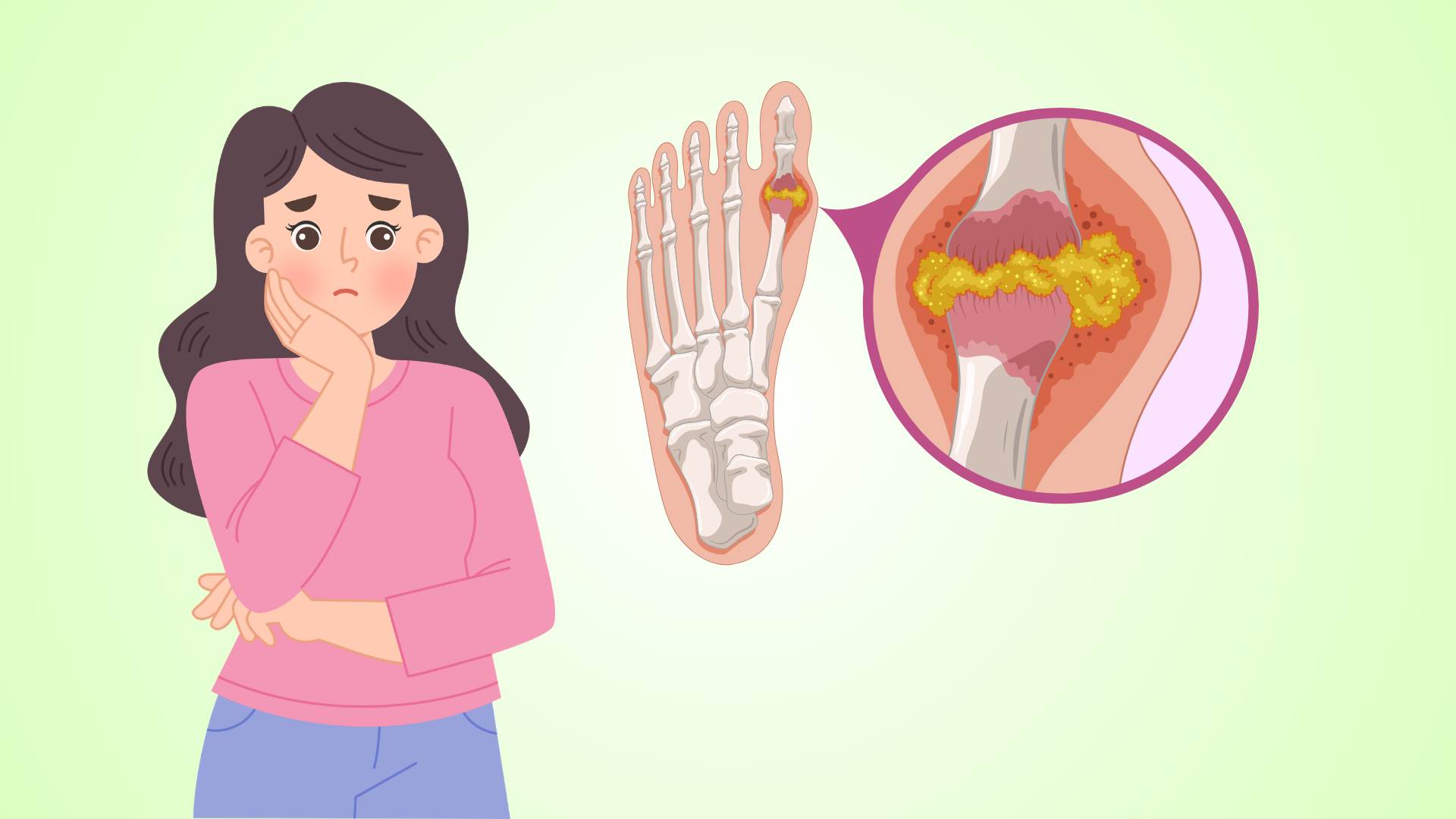 Some seemingly harmless daily habits cause increased uric acid. Photo: An Phuong