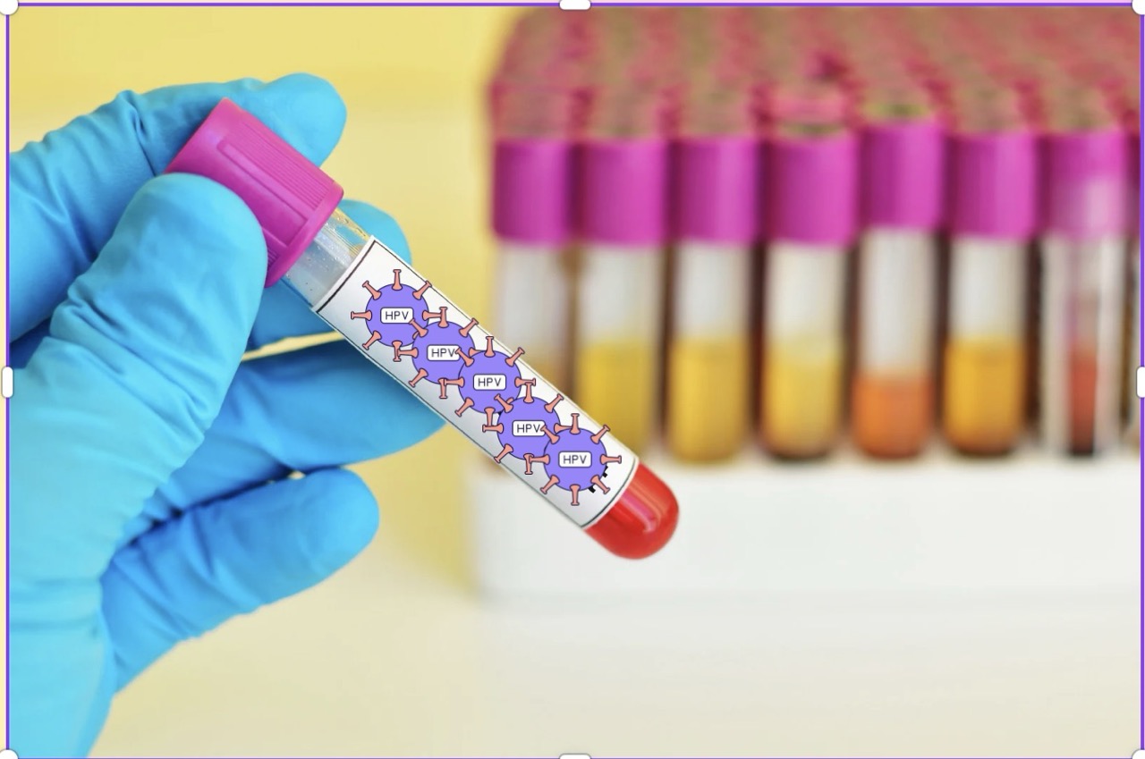 Some topical medications of unknown origin or containing corticosteroids can impair local immunity, creating conditions for the HPV virus to develop more strongly, causing genital warts to spread. Graphics: Huong Giang