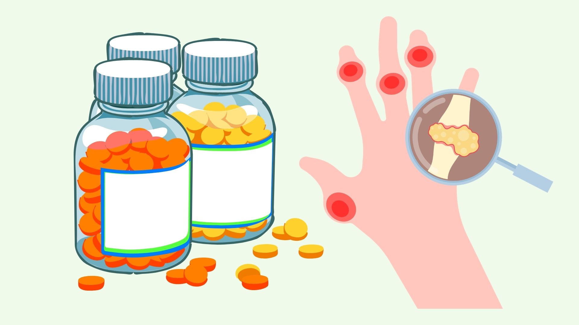 High uric acid may be due to the medication you are taking. Graphics: Linh Dan