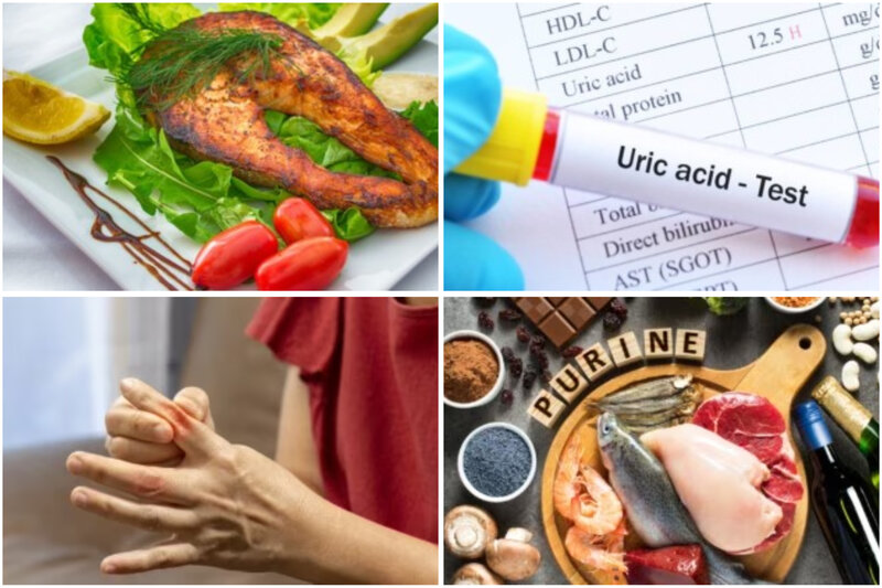 Body aches, swelling in the legs and joints are some signs of high uric acid in the body. Graphics: Thuy Duong