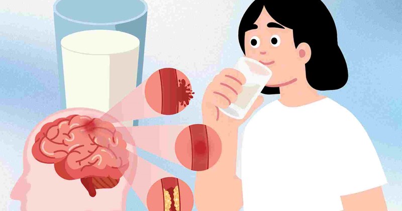 Uống sữa mỗi ngày giảm 10% nguy cơ đột quỵ