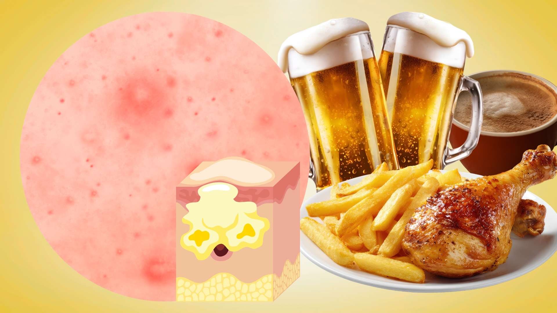 5 food groups that help reduce hidden acne