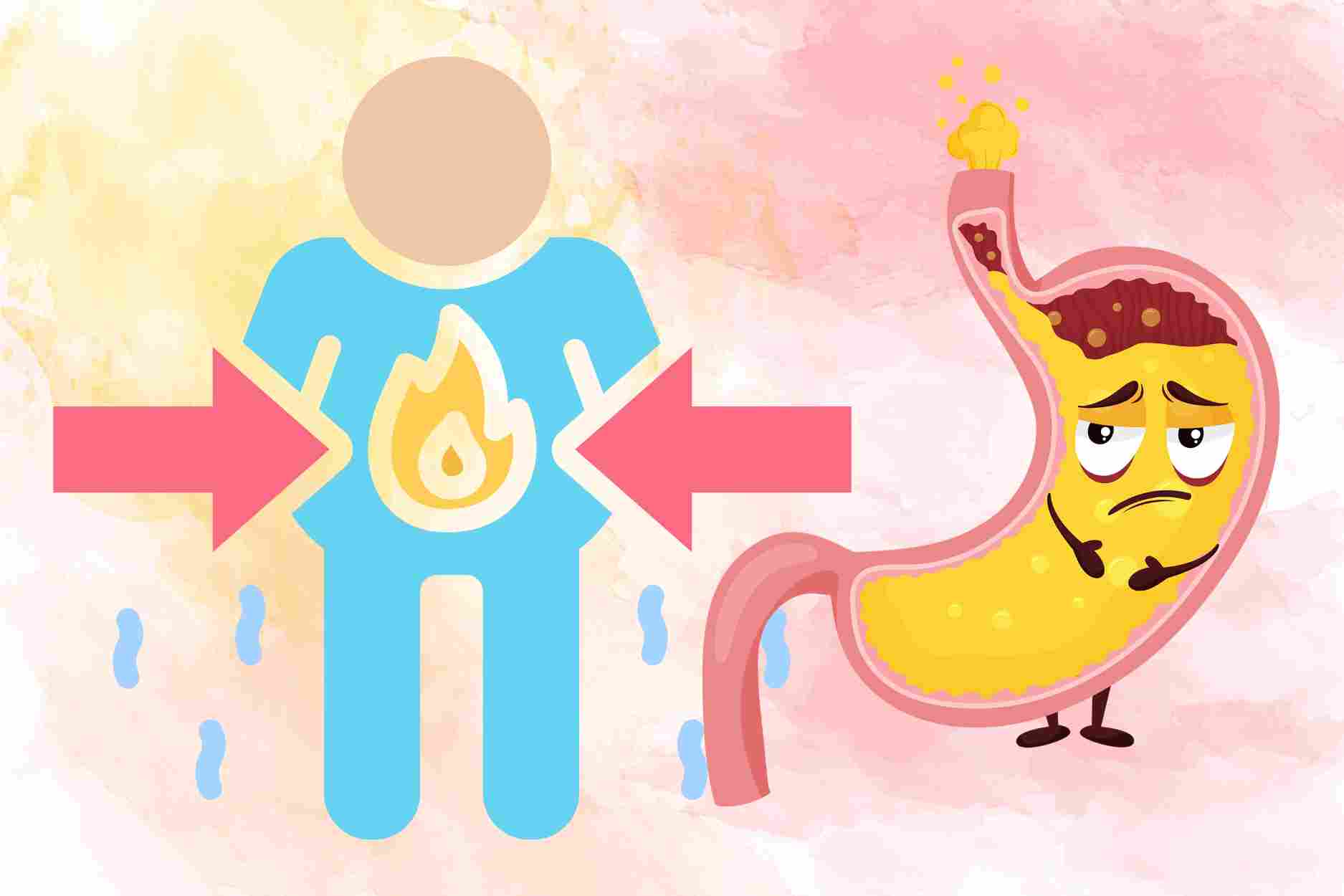 High body fat silently causes stomach reflux