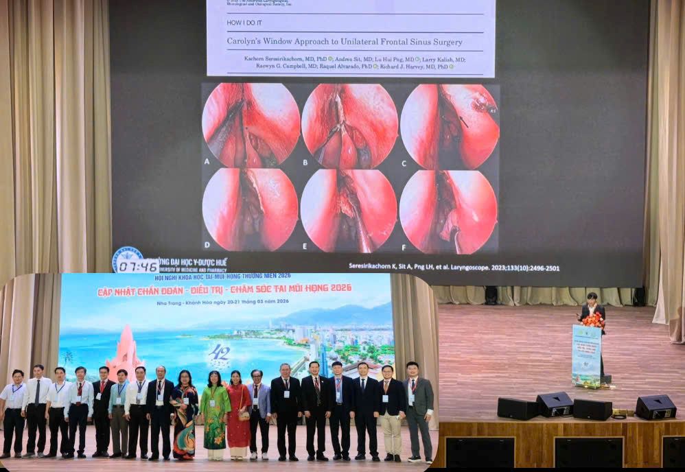 Experts present new applications in Ear, Nose and Throat Treatment. Photo: Phuong Linh