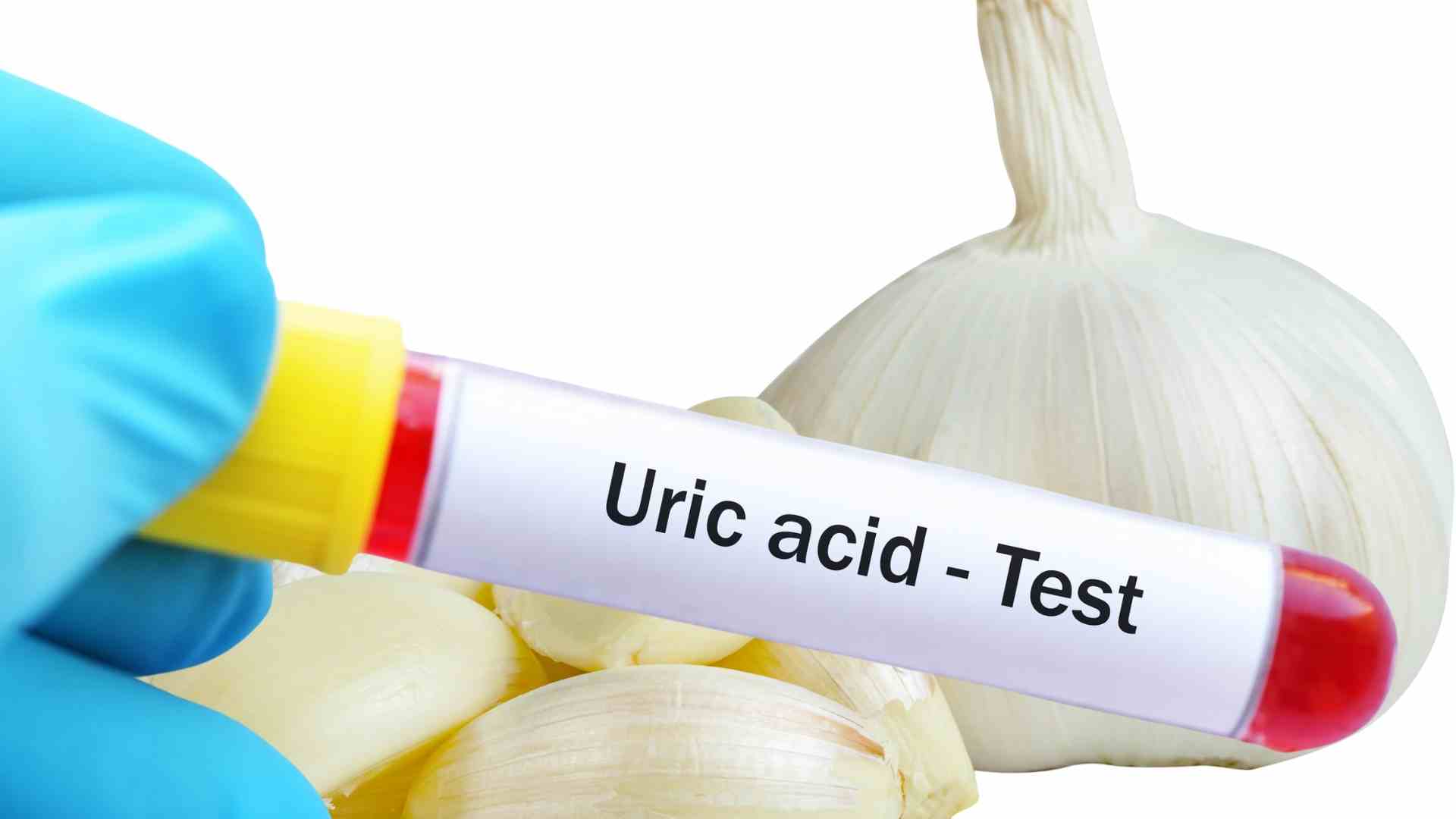 Supplementing garlic properly helps control uric acid. Graphics: Ha May