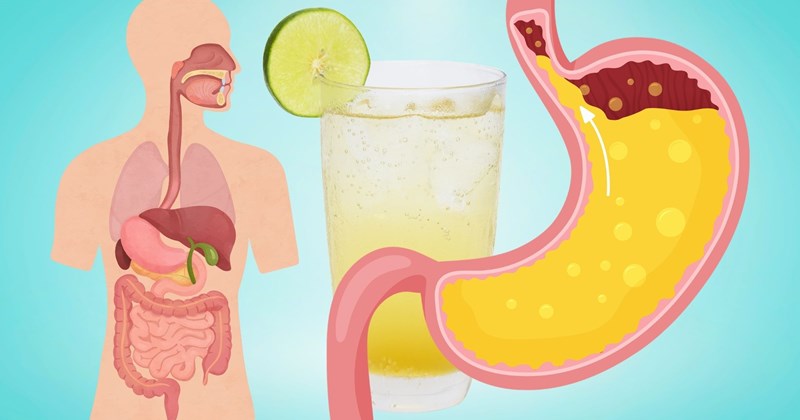 Uống nước chanh muối không chữa trào ngược dạ dày
