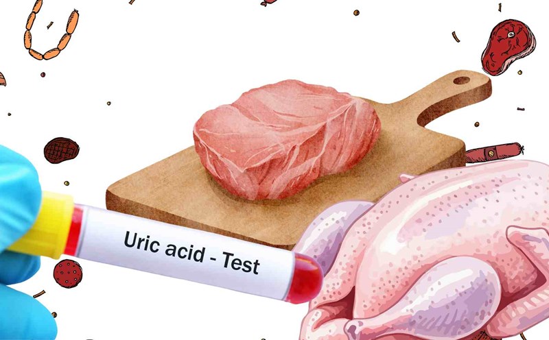 People with high uric acid should eat meat properly to avoid affecting their health. Graphics: Ha May