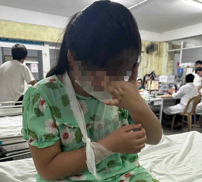 Student beaten by teacher Photo: Q. An.