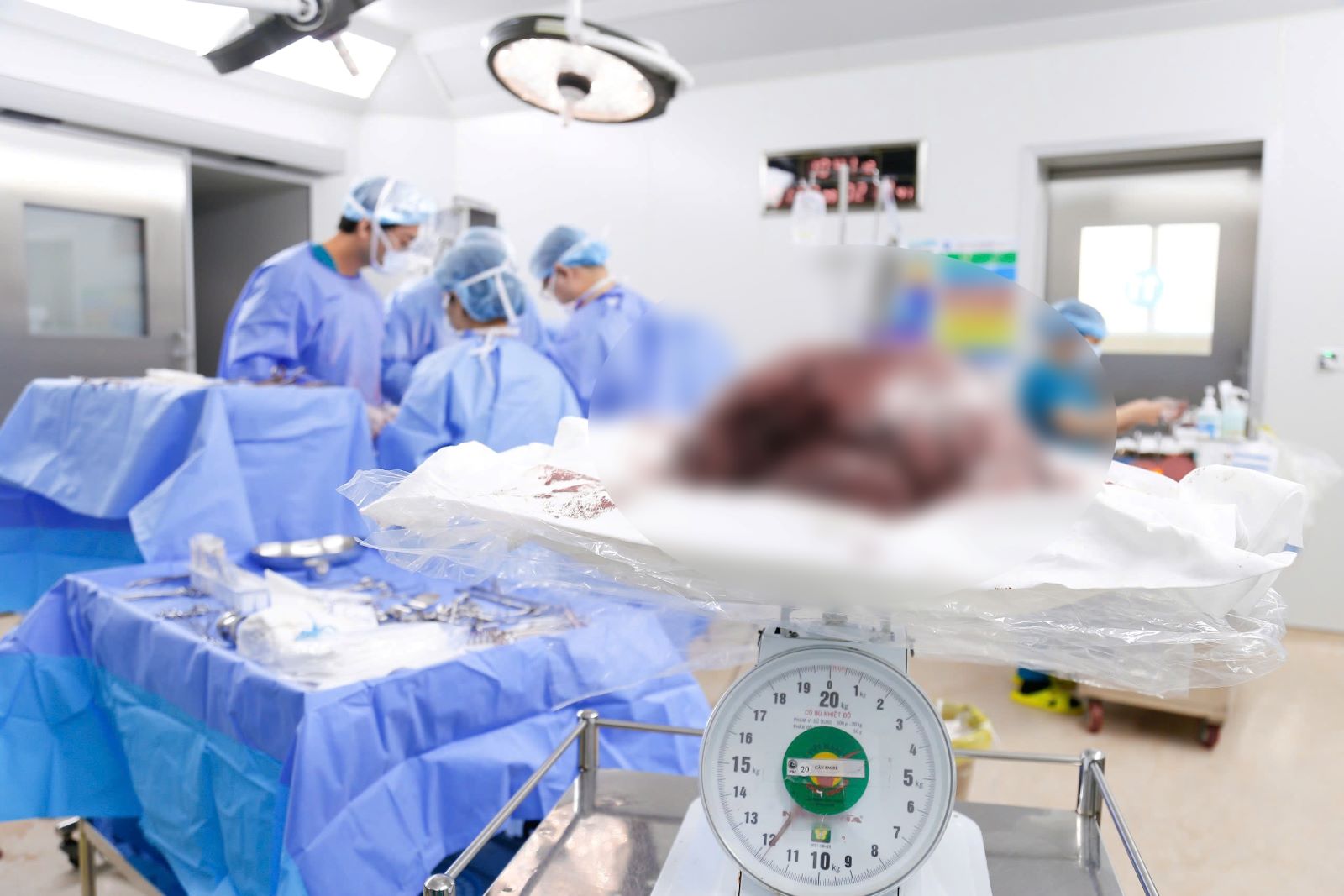 Close-up of surgery to remove a giant uterine fibroid tumor, weighing nearly 12kg