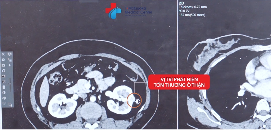 Việc phát hiện ung thư giai đoạn sớm và có được phương pháp điều trị phù hợp rất quan trọng để bệnh được xử lý hiệu quả. Ảnh: NURA Việt Nam