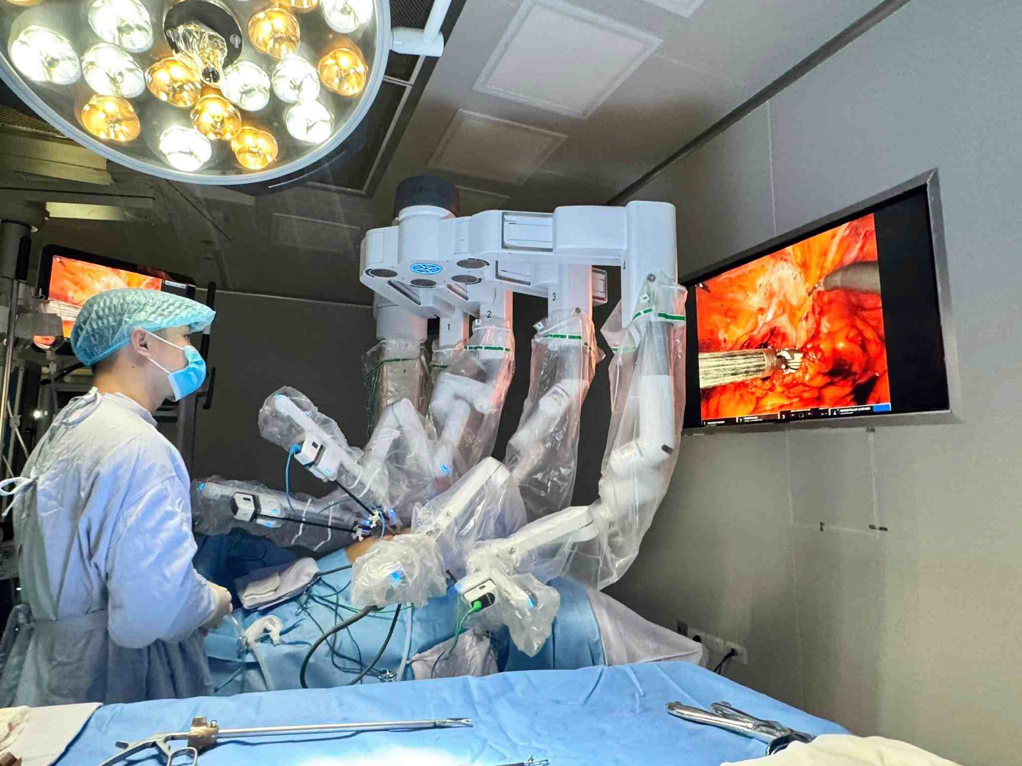 Cancer relapses after 10 years, patient revives thanks to robot. Photo: BVCC