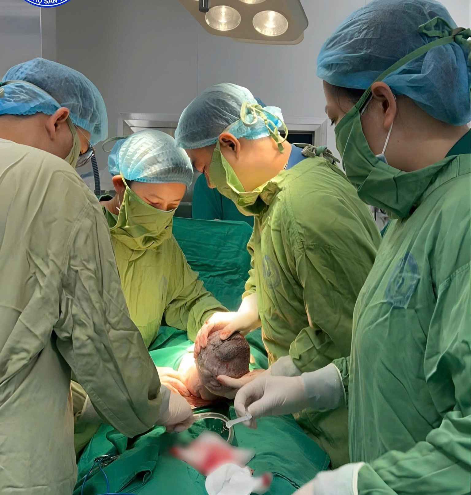 Các bác sĩ thực hiện ca mổ lấy thai cho bệnh nhân đặt dẫn lưu màng phổi thai nhi tuần thứ 32. Ảnh: BVCC